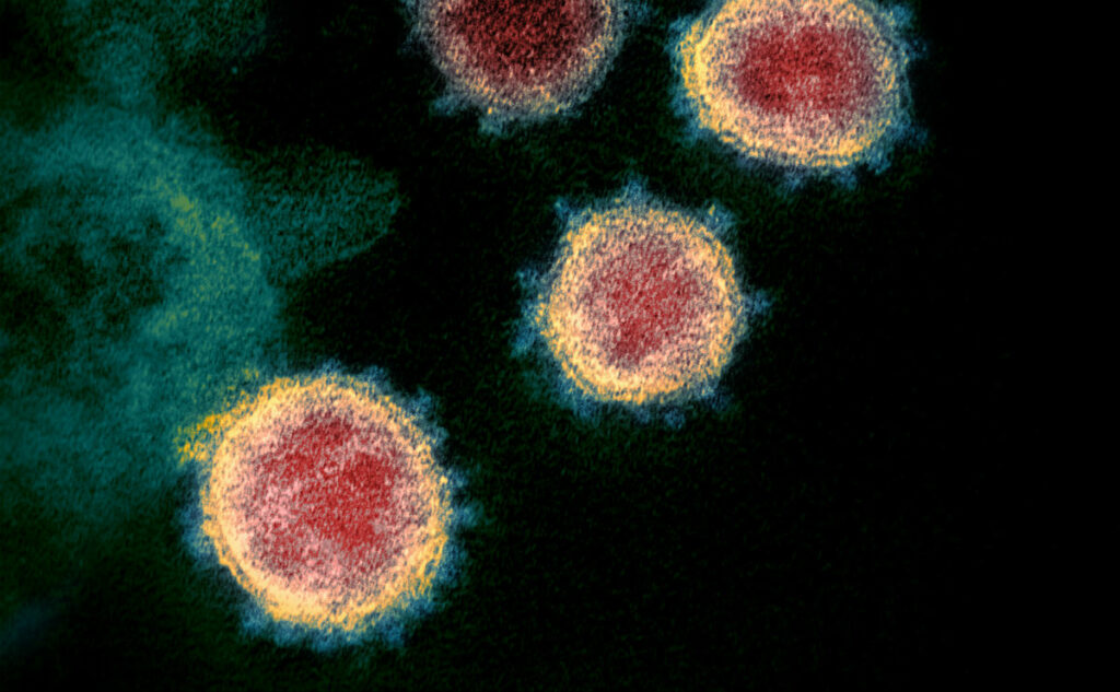 新冠病毒对华州经济和行业的影响